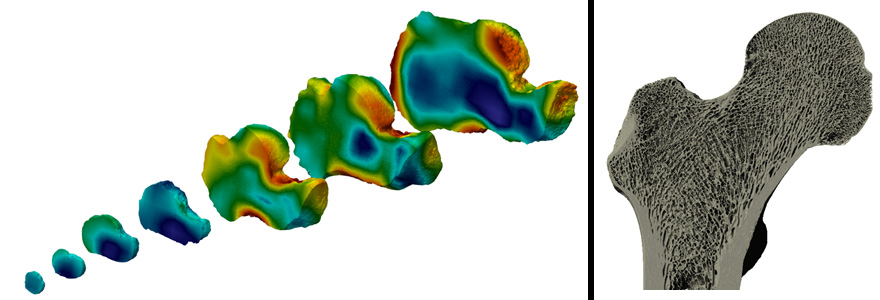 On left, digital models of bones showing age related changes in bone density in the human heel bone (calcaneus). On right, a digital model of the three dimensional structure of trabecular bone in the human hip.